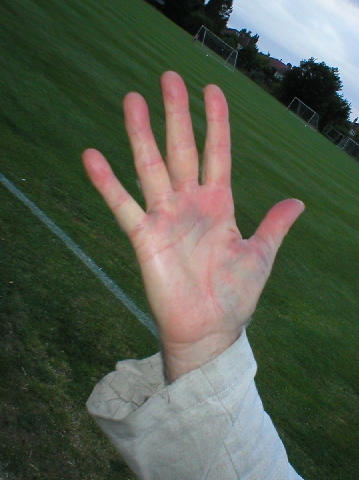 Mike Sneyd's hand.